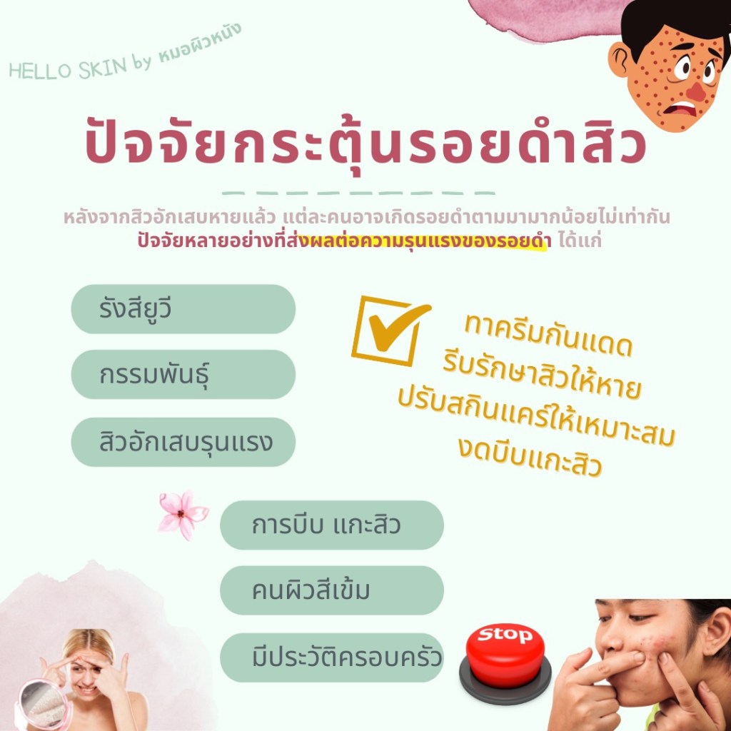 ปัจจัยกระตุ้นรอยดำสิว 