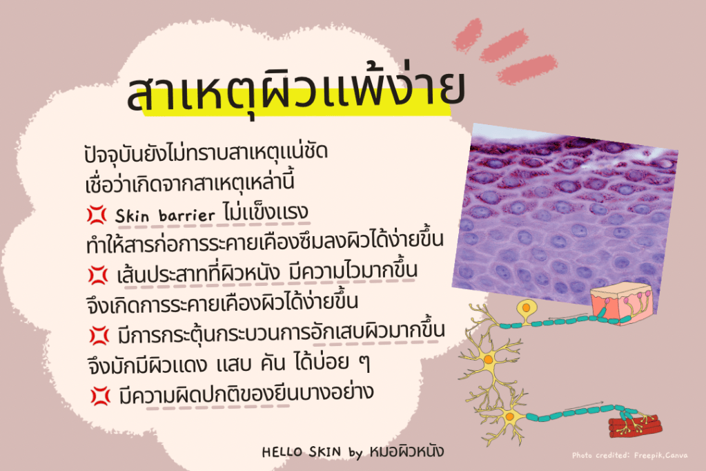 สาเหตุผิวแพ้ง่าย