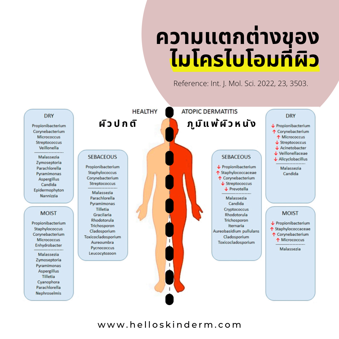 ความแตกต่างของ skin microbiome helloskinderm 