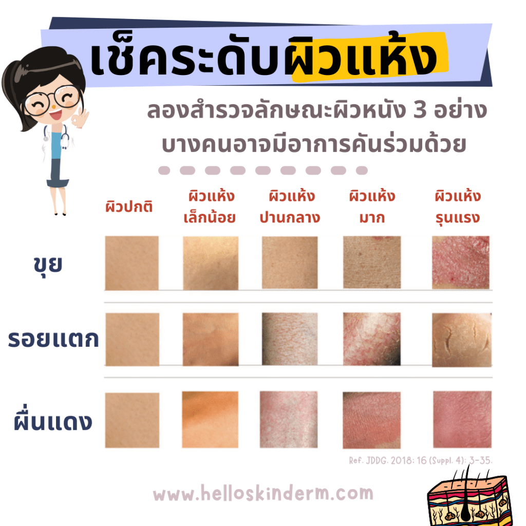 เช็คระดับผิวแห้ง