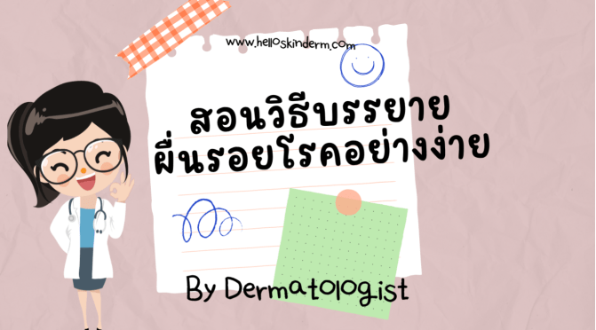 สอนวิธีบรรยายรอยโรคผื่นอย่างง่าย