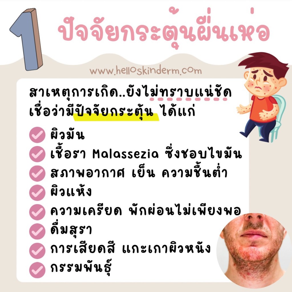 ปัจจัยกระตุ้นเซ็บเดิร์ม
