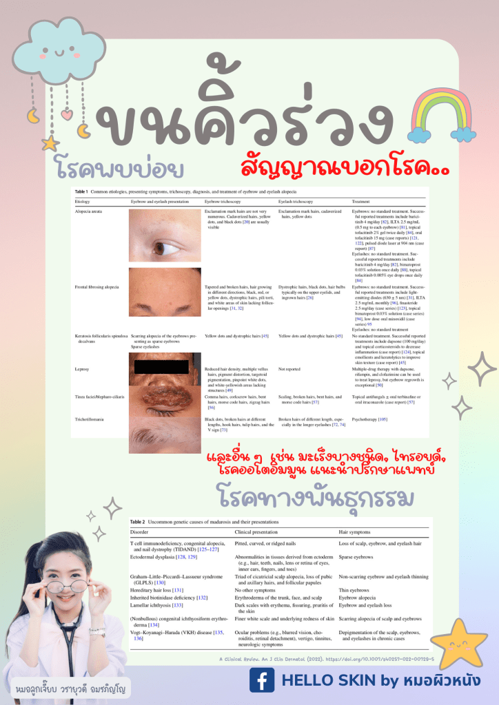 ขนคิ้วร่วง madarosis