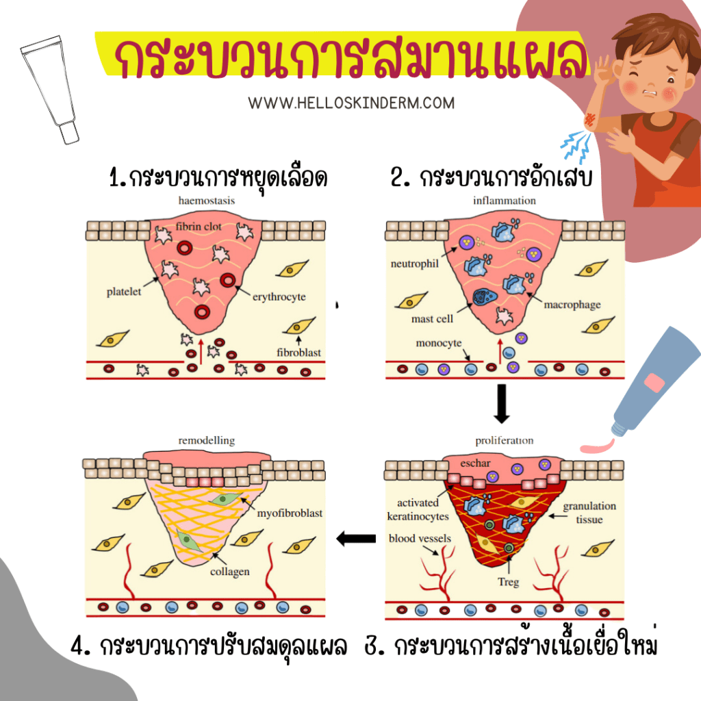 การสมานแผล