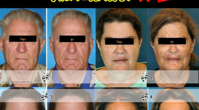 15 ข้อควรรู้..ความแก่ก่อนวัยจากการสูบบุหรี่